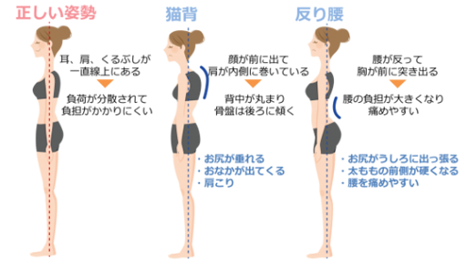 【猫背・反り腰など姿勢不良は“美容の悩み”の大敵】
