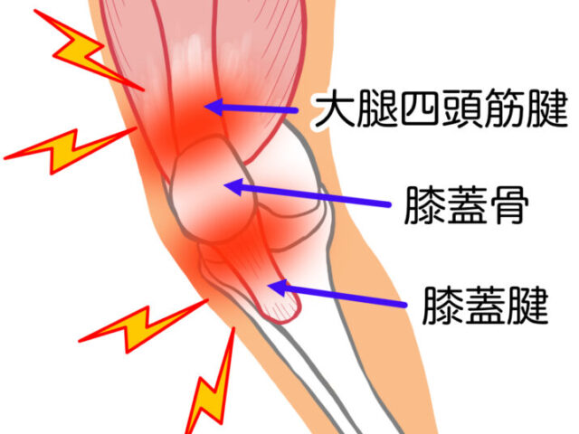 膝の痛みについて｜40代以降に増える原因と整骨院での対応