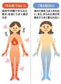 冷え性と筋肉の関係について～なぜ筋肉が冷え性に影響するのか？～