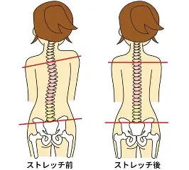 気づかないうちに進む骨盤の傾きと身体への影響とは