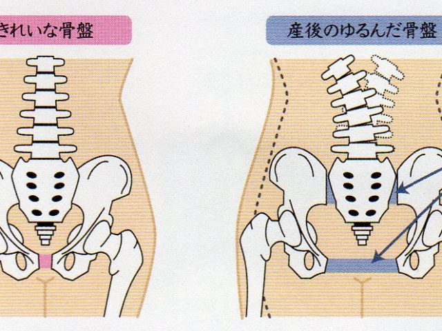 産後の骨盤の歪みと腰痛を改善｜育児中でも無理なく整える方法とは